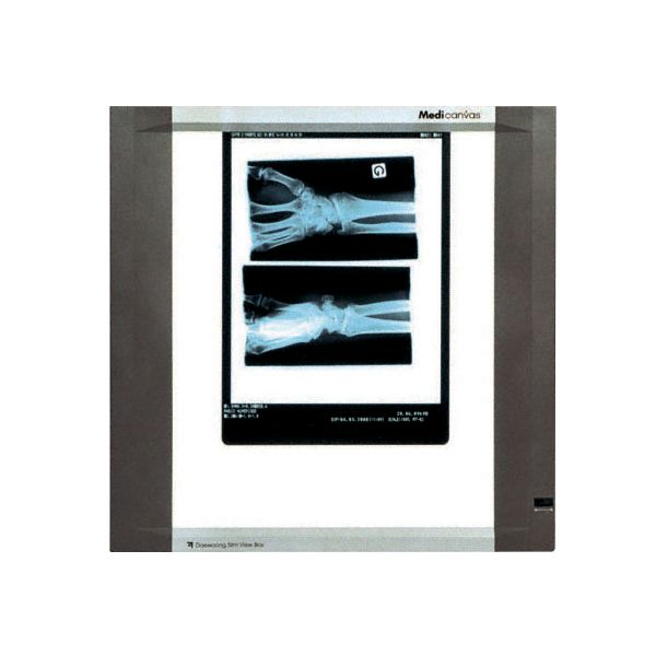 Négatoscopes extra-plats